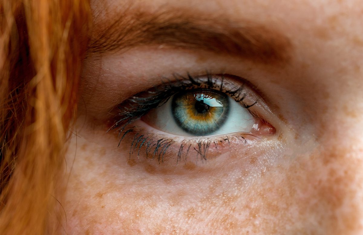 Eyelid correction at the GP? Why at Boerhaave specialisation is essential.