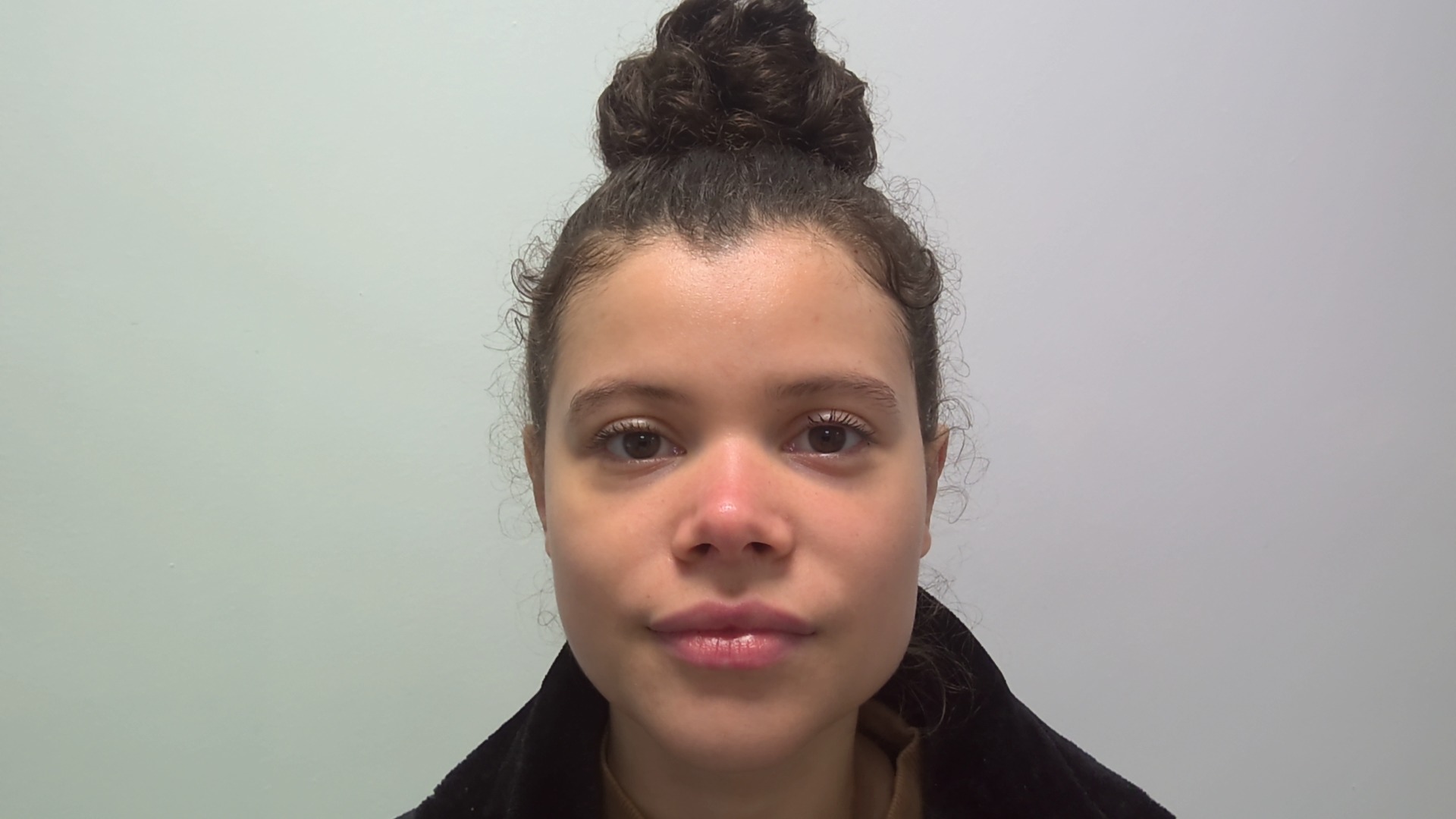 Ear correction after