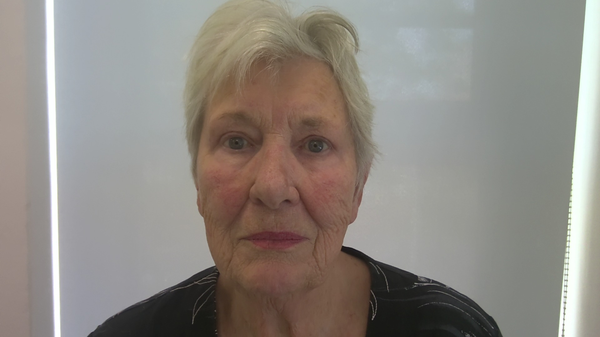 Eyelid correction after