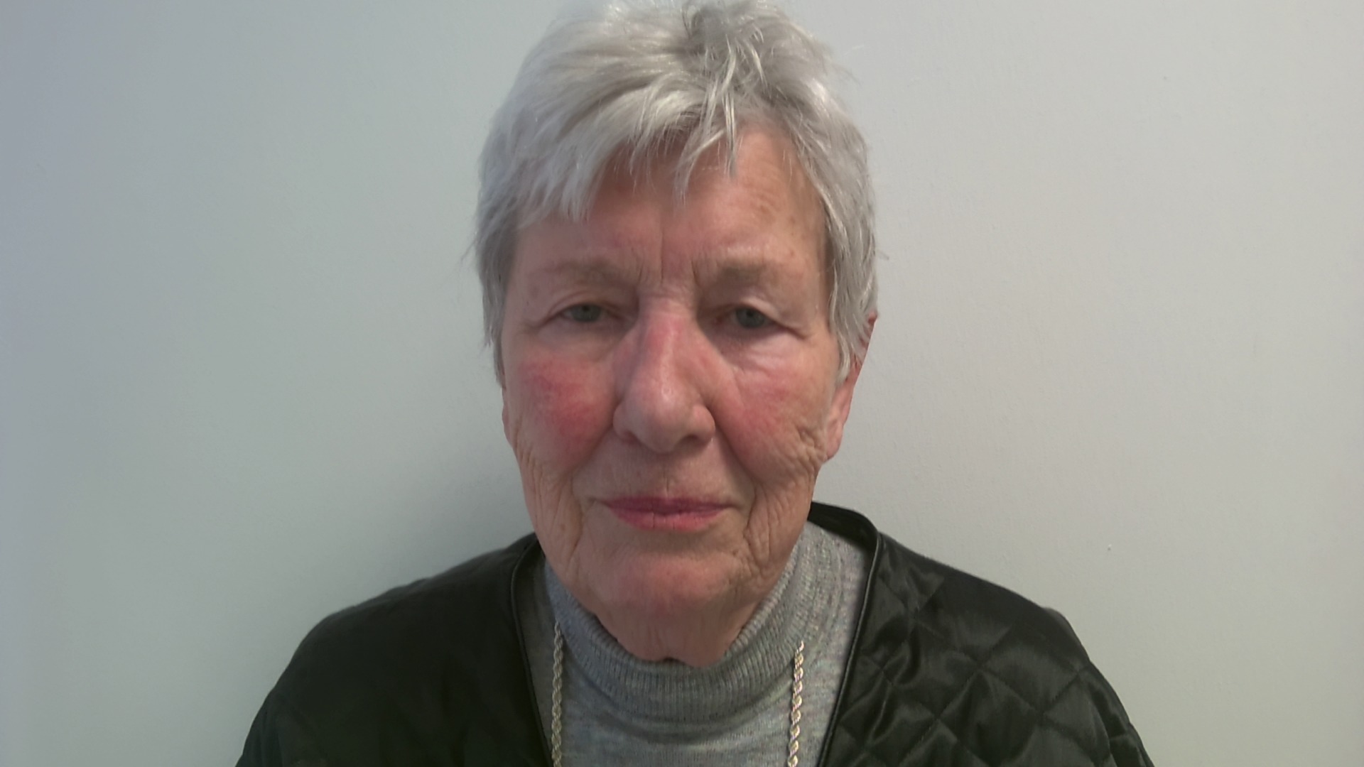 Eyelid correction before