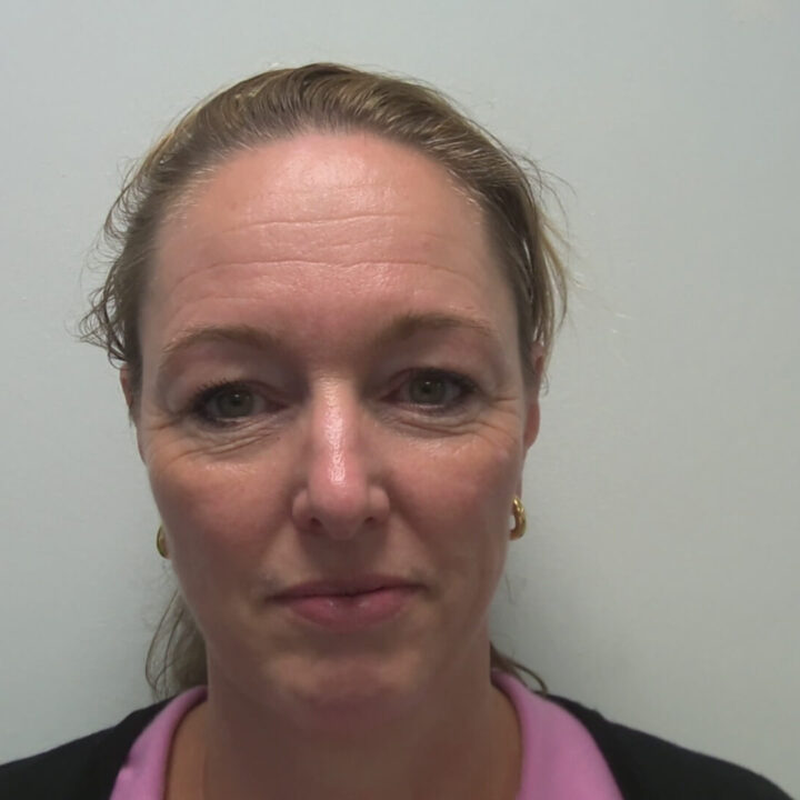 Eyelid correction before