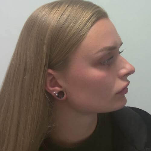 Nose correction before