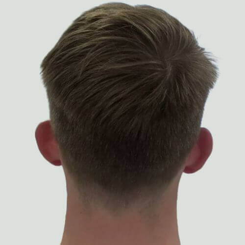 Ear correction before