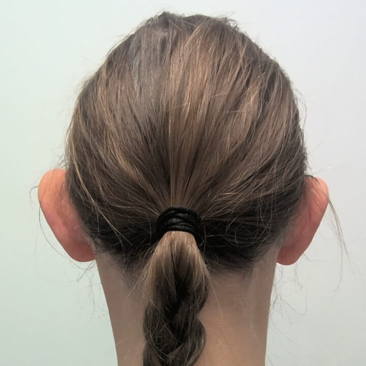 Ear correction before