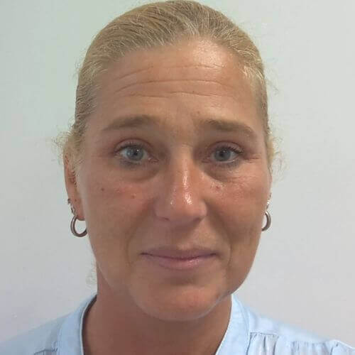 Eyelid correction after