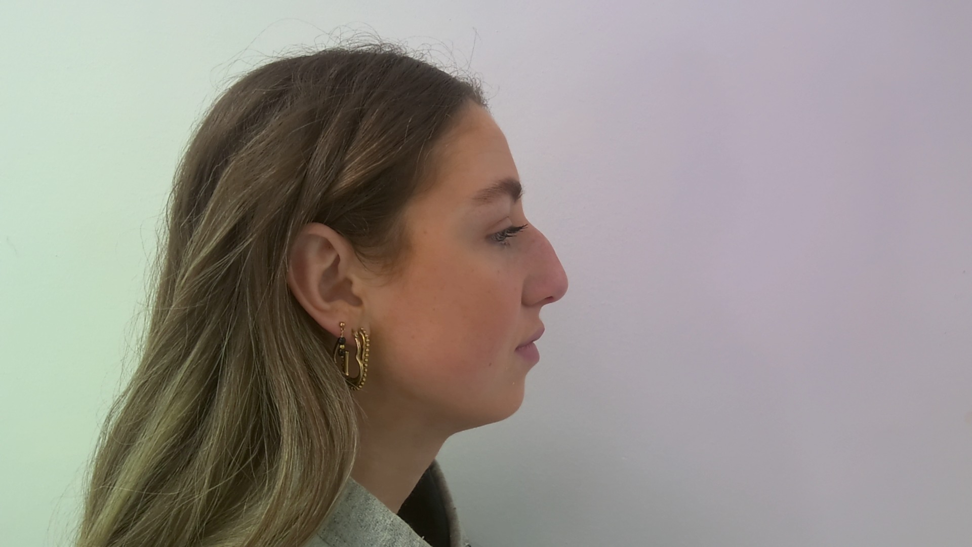 Nose correction before