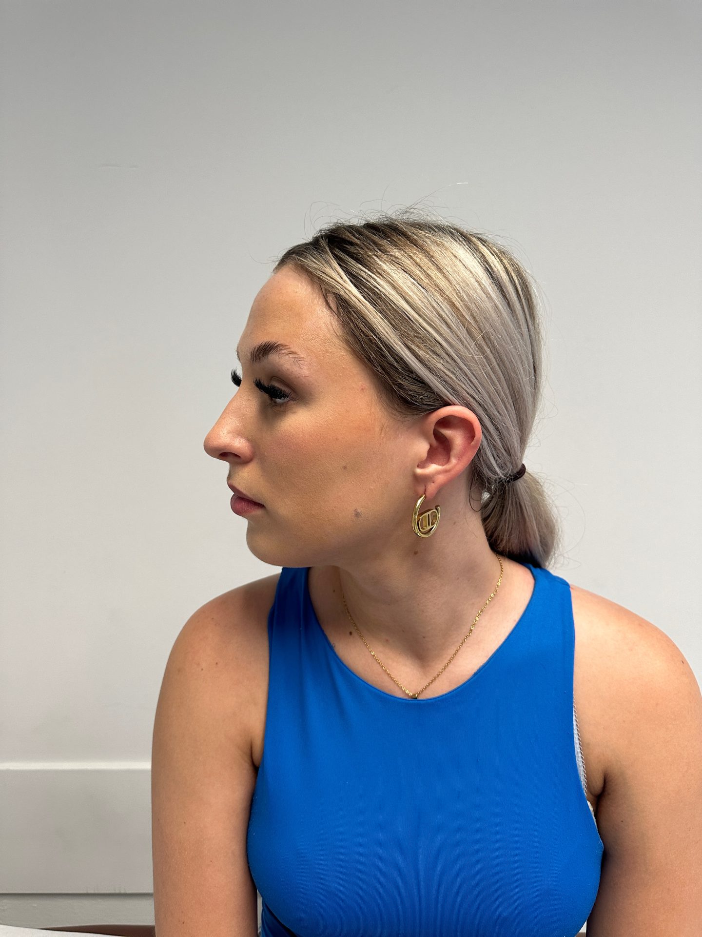 Nose correction before
