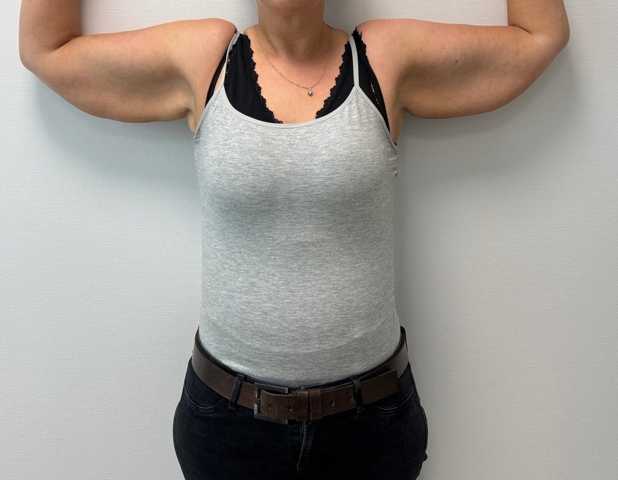 Armlift voor