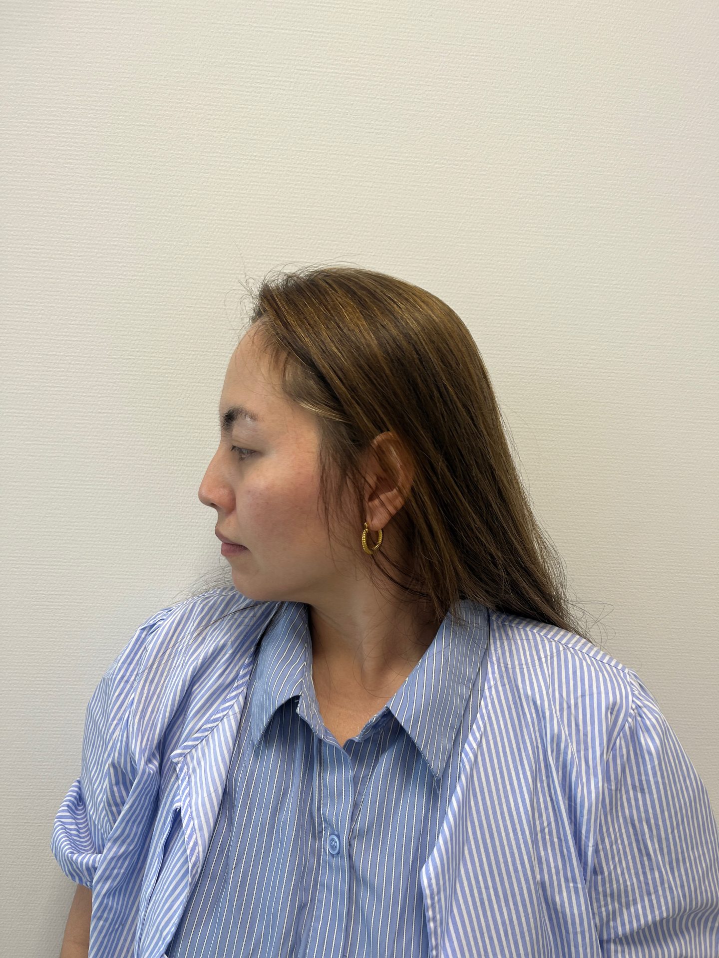 Nose correction before