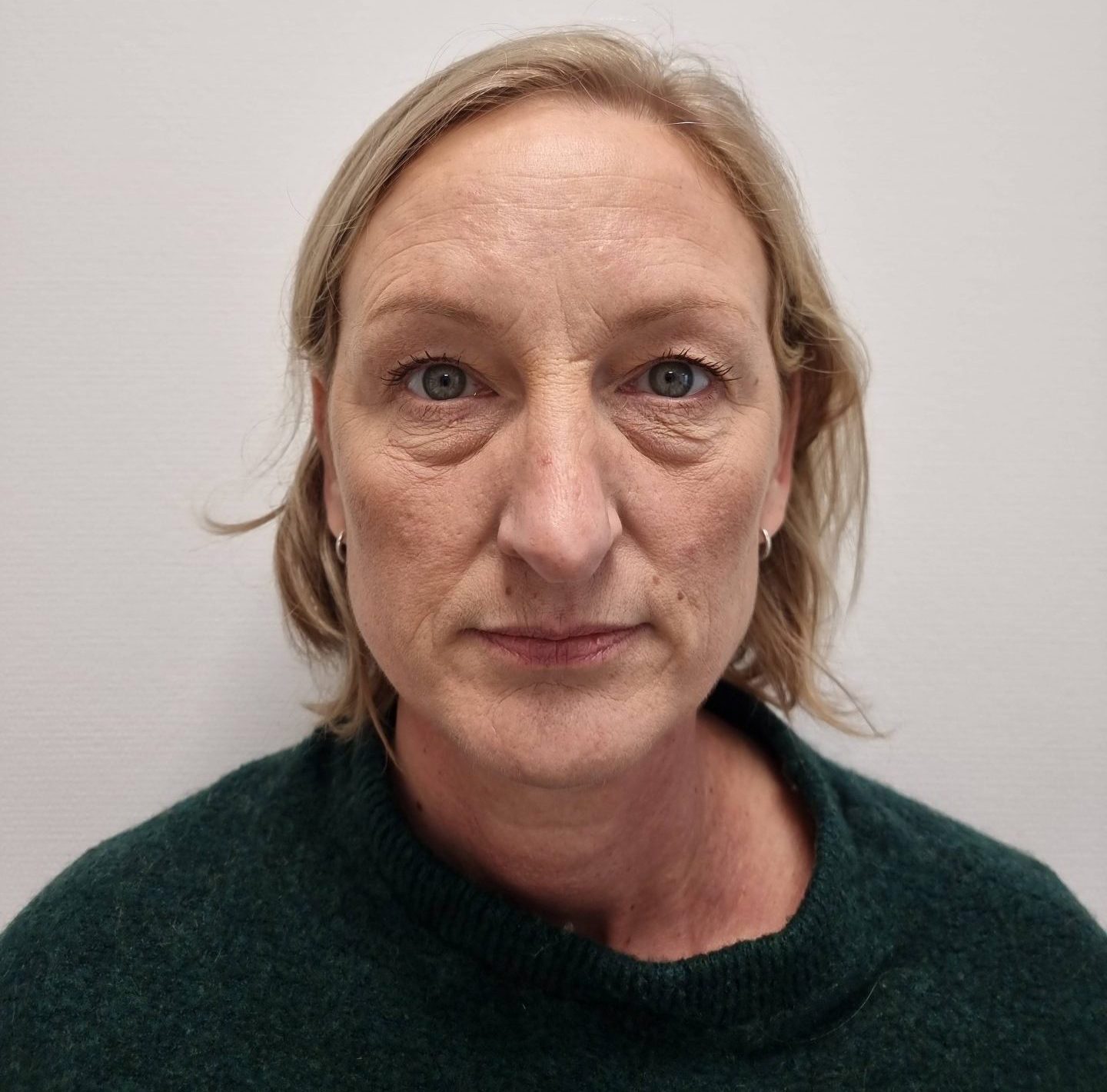 Eyelid correction before