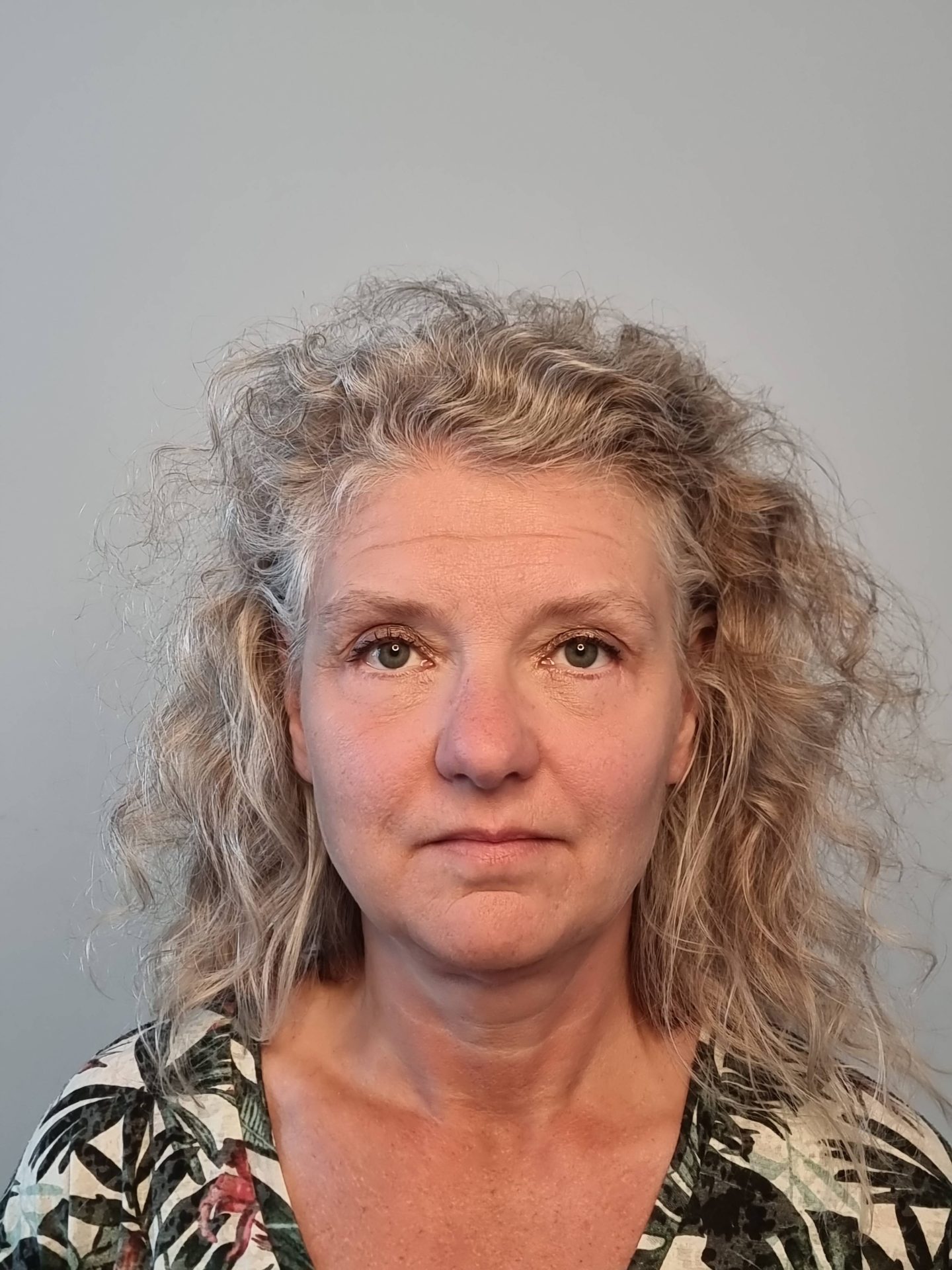 Eyelid correction after