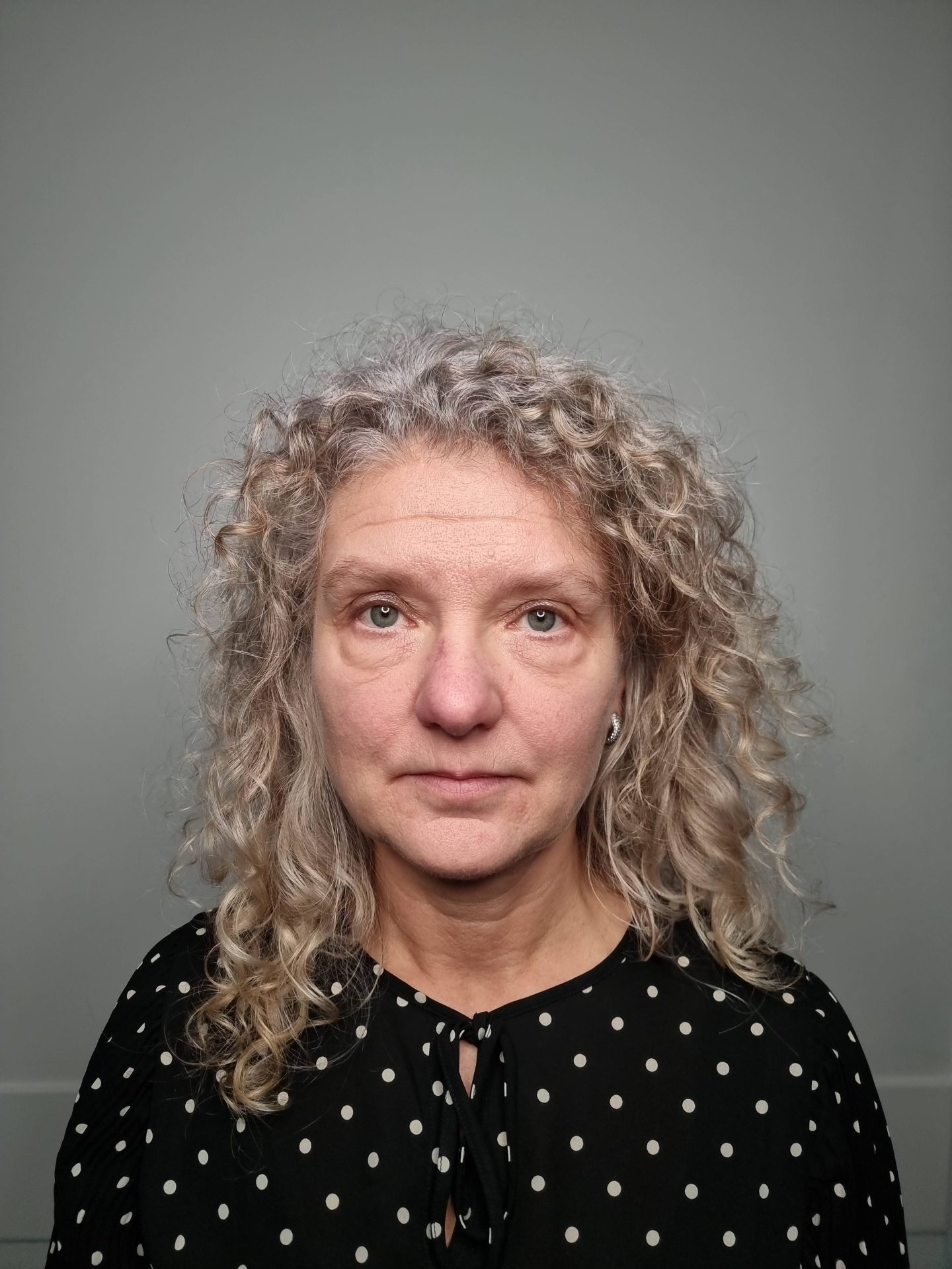 Eyelid correction before