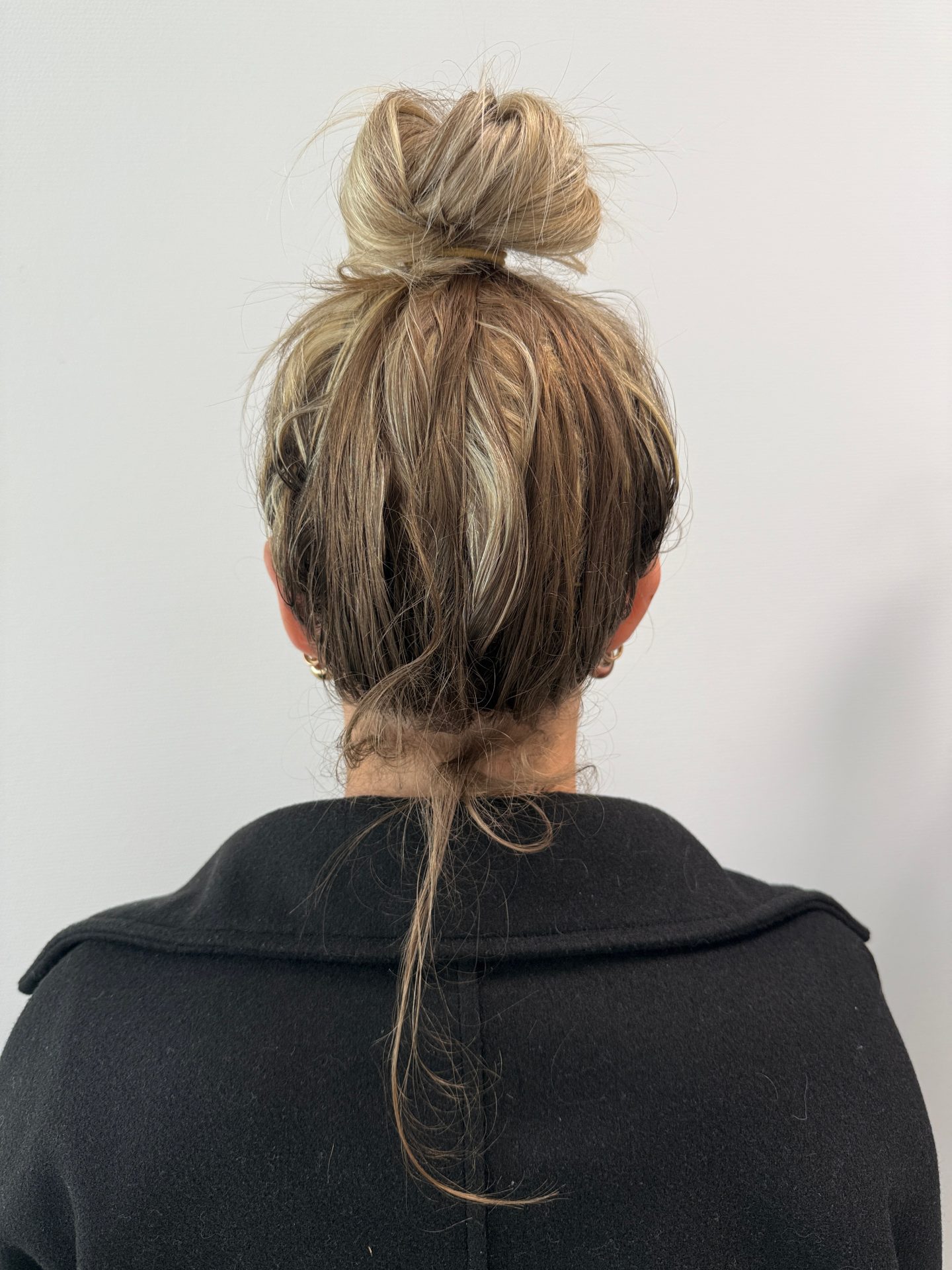 Ear correction after
