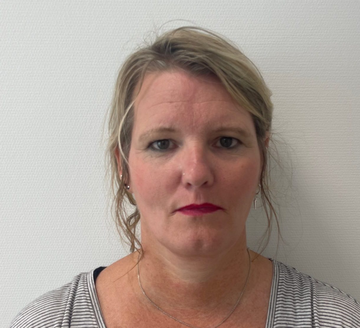 Eyelid correction before