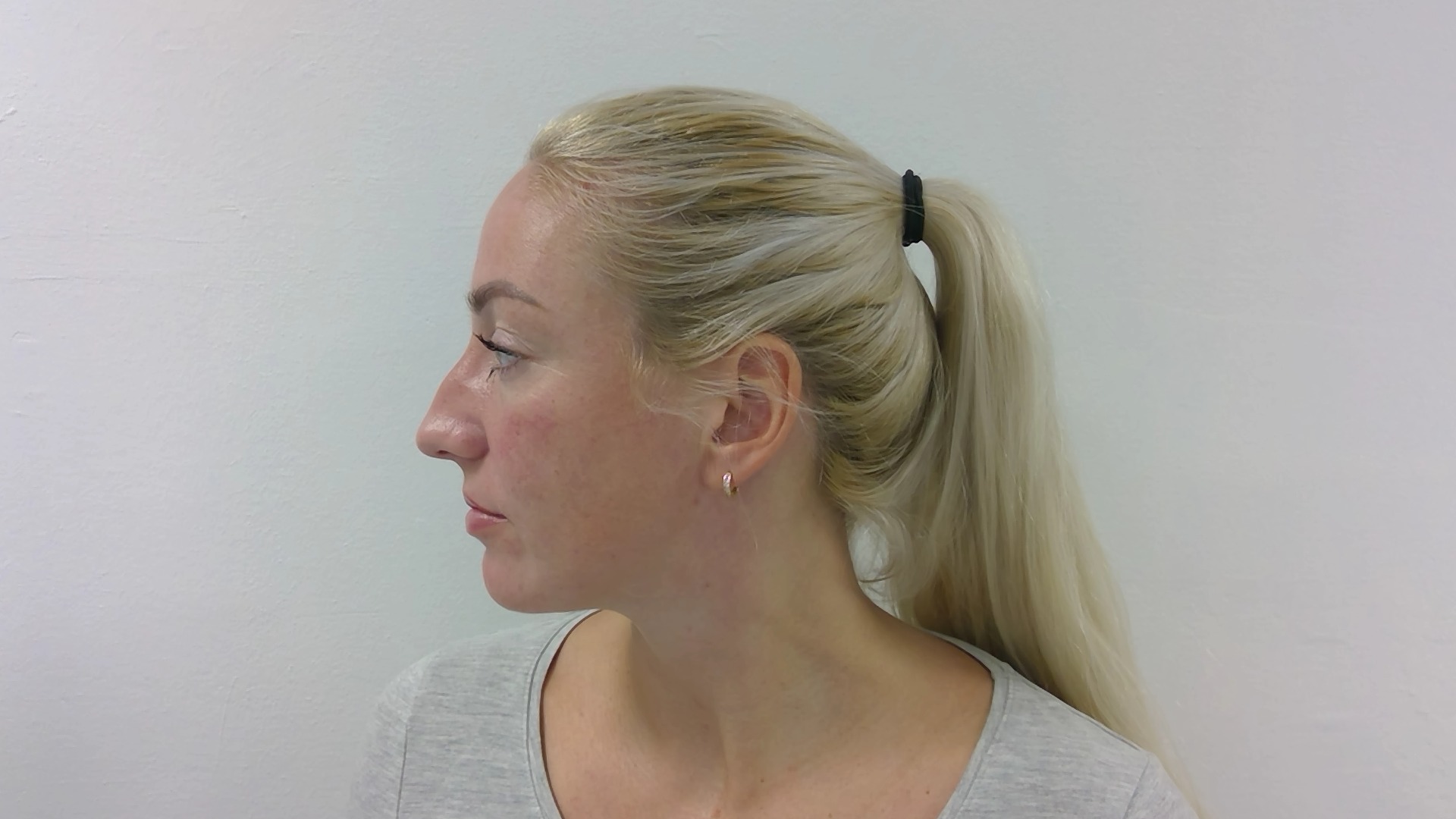 Nose correction before