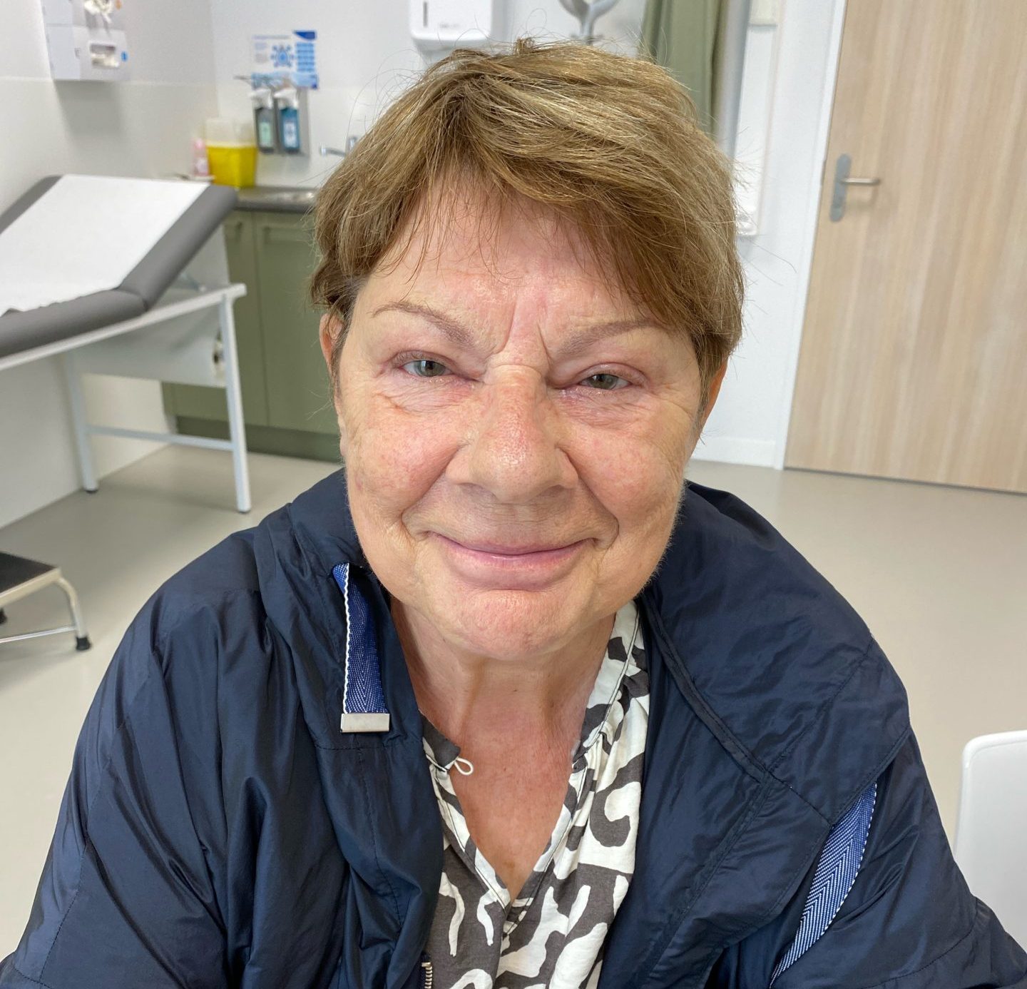 Eyelid correction after