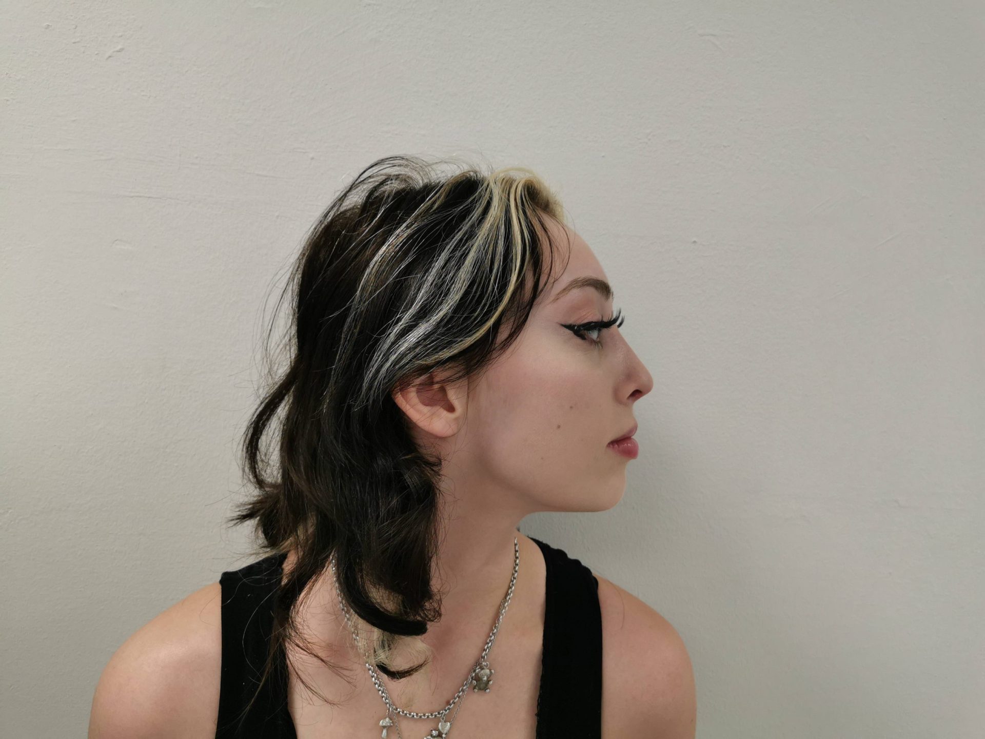 Nose correction after