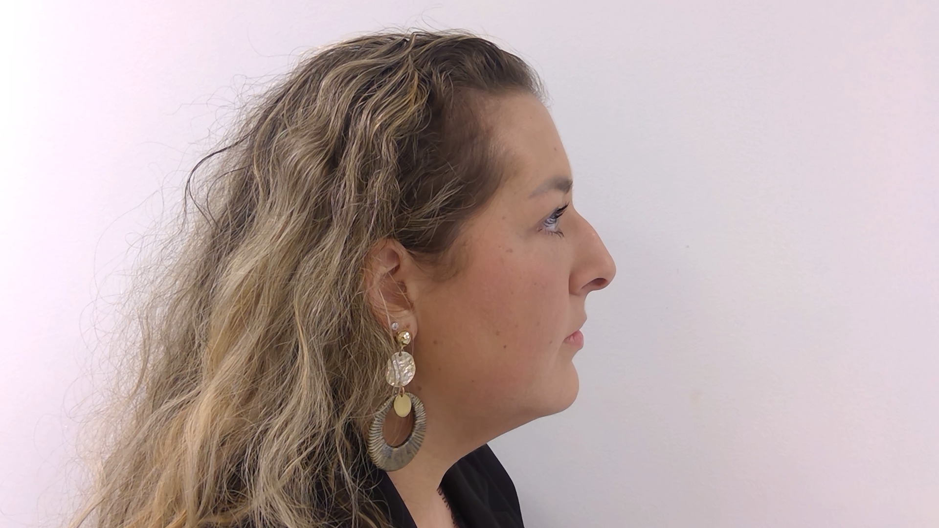 Nose correction before