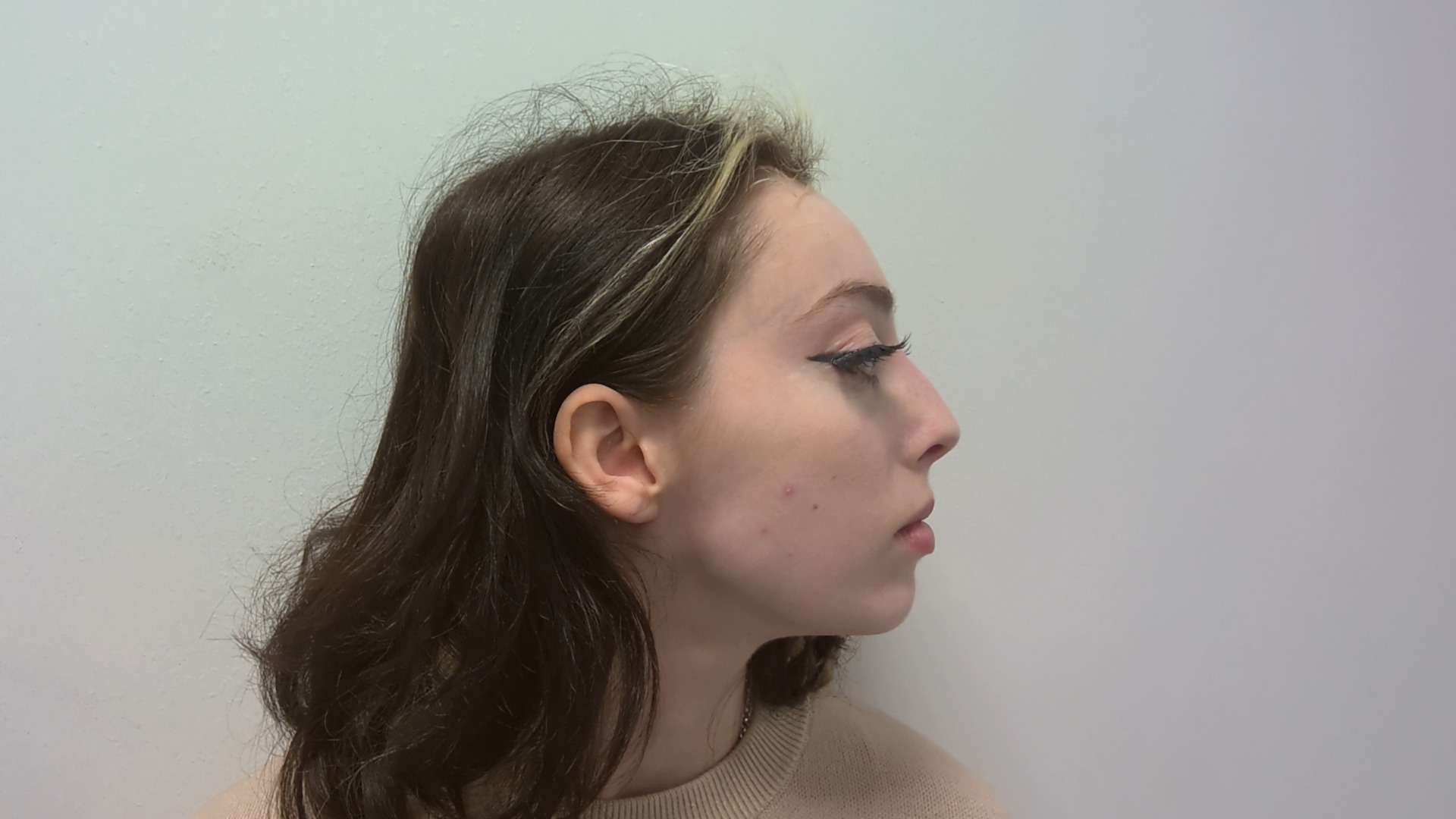 Nose correction before