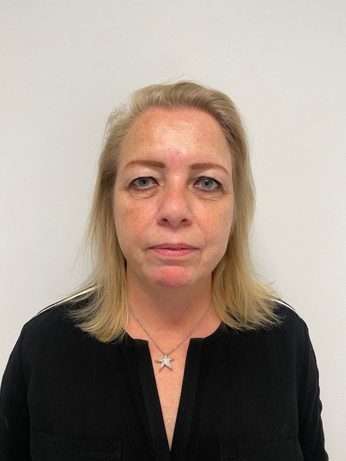 Eyelid correction before