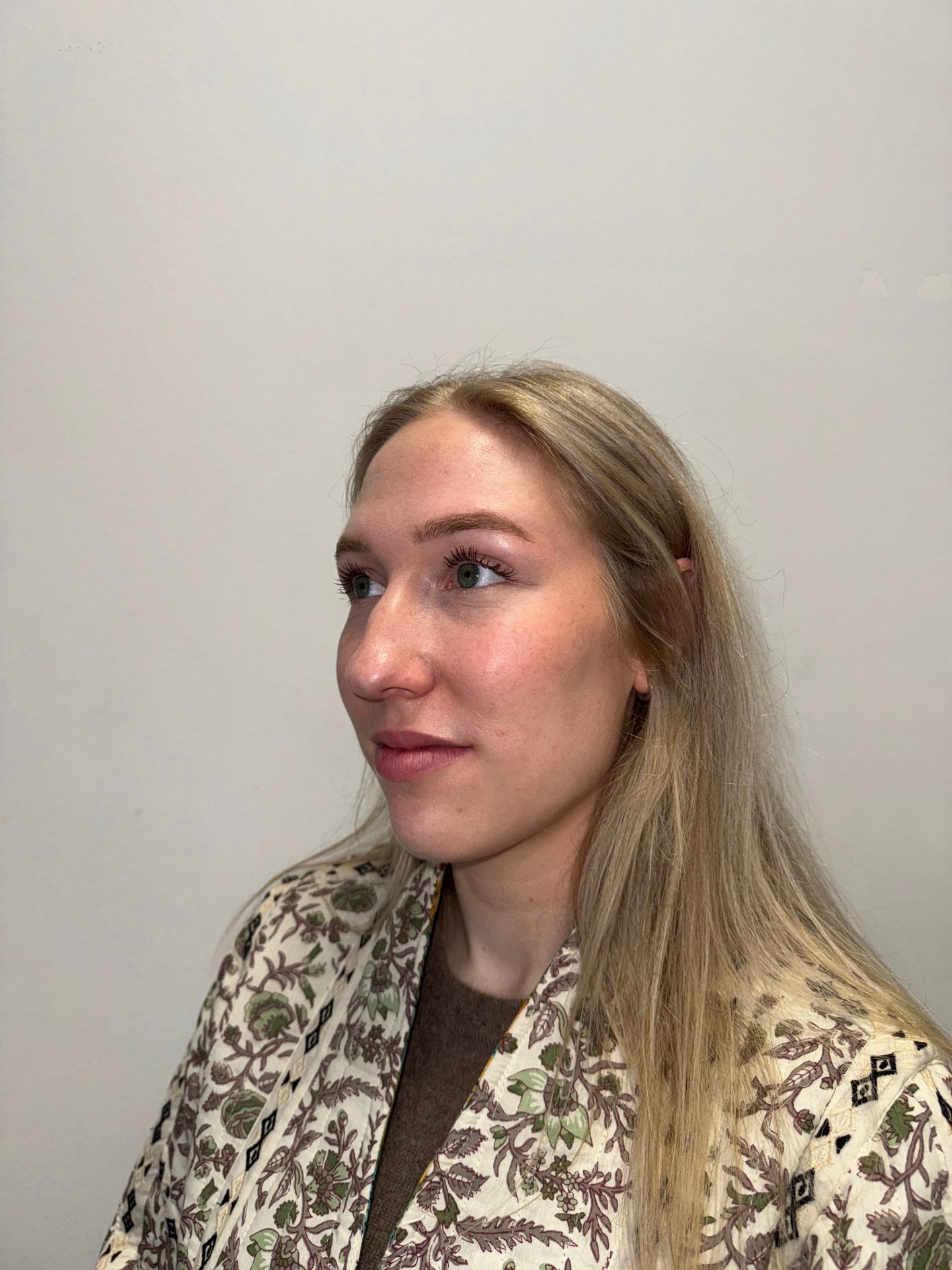 Nose correction before