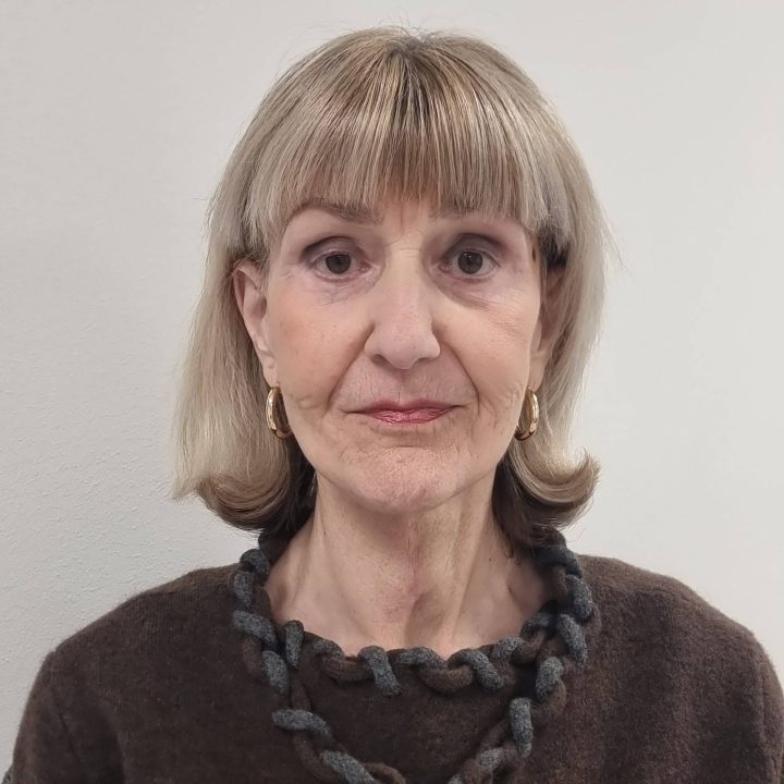 Neck facelift after