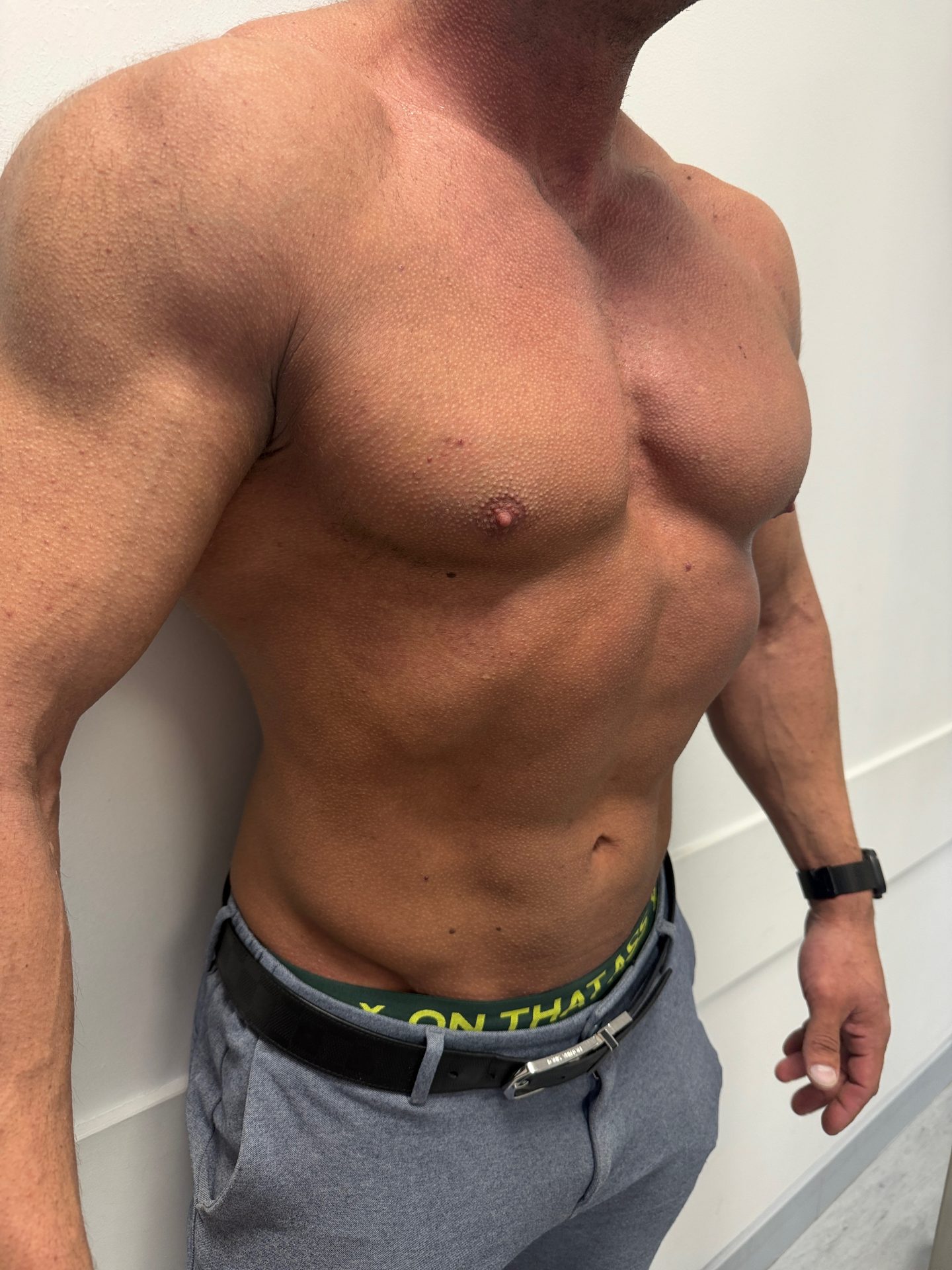 Breast correction for men after