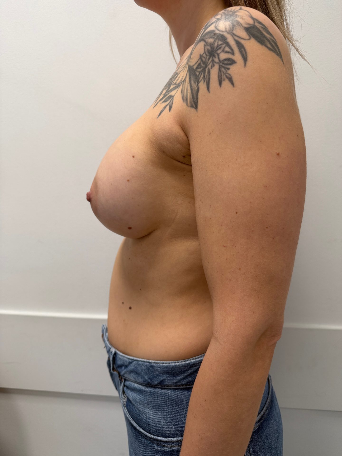 na