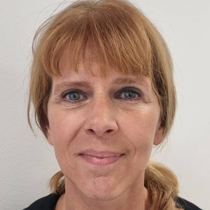 Neck facelift after