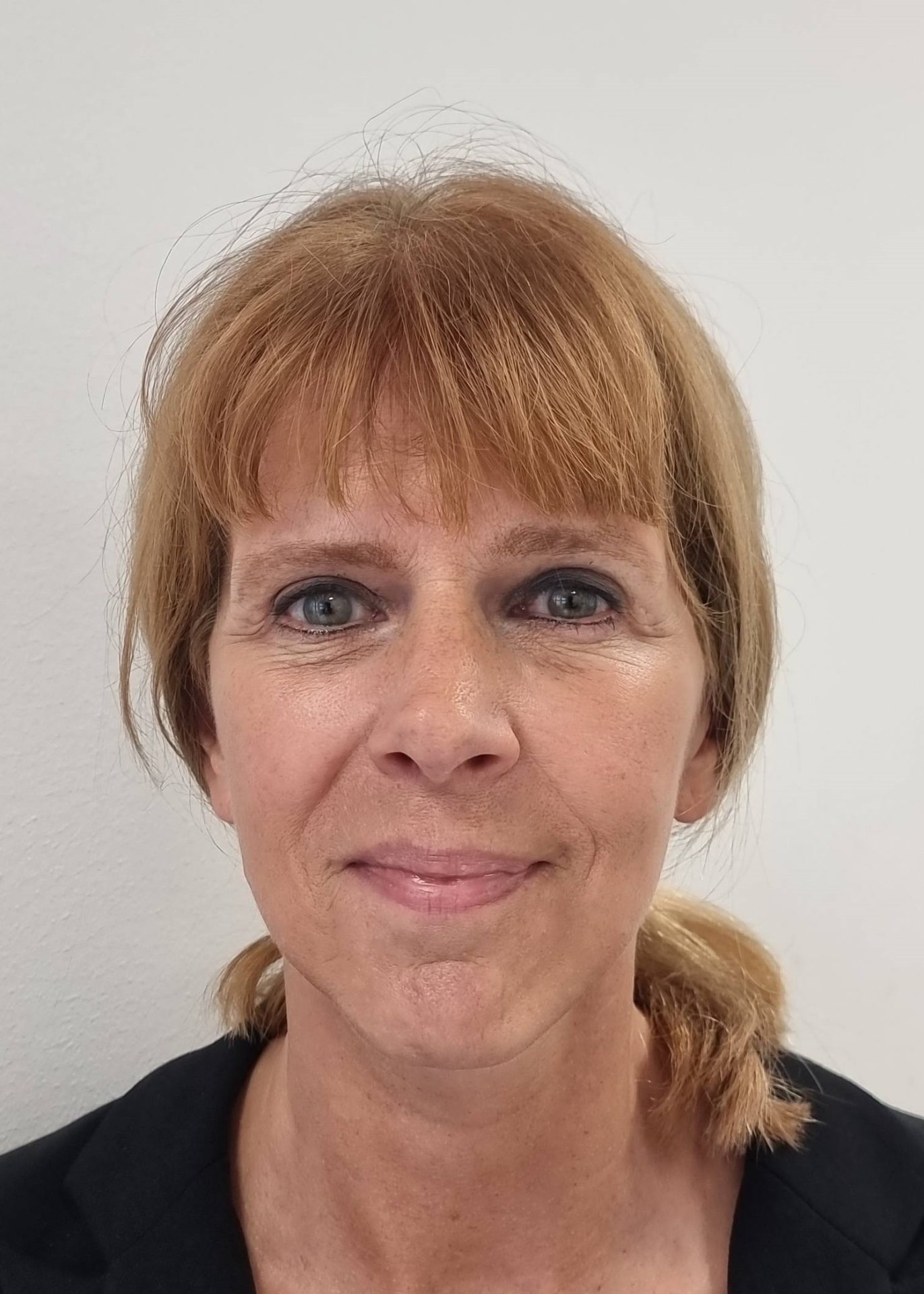 Neck facelift after