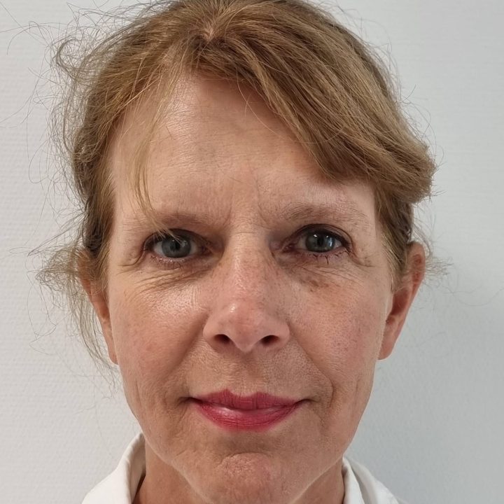 Neck facelift before
