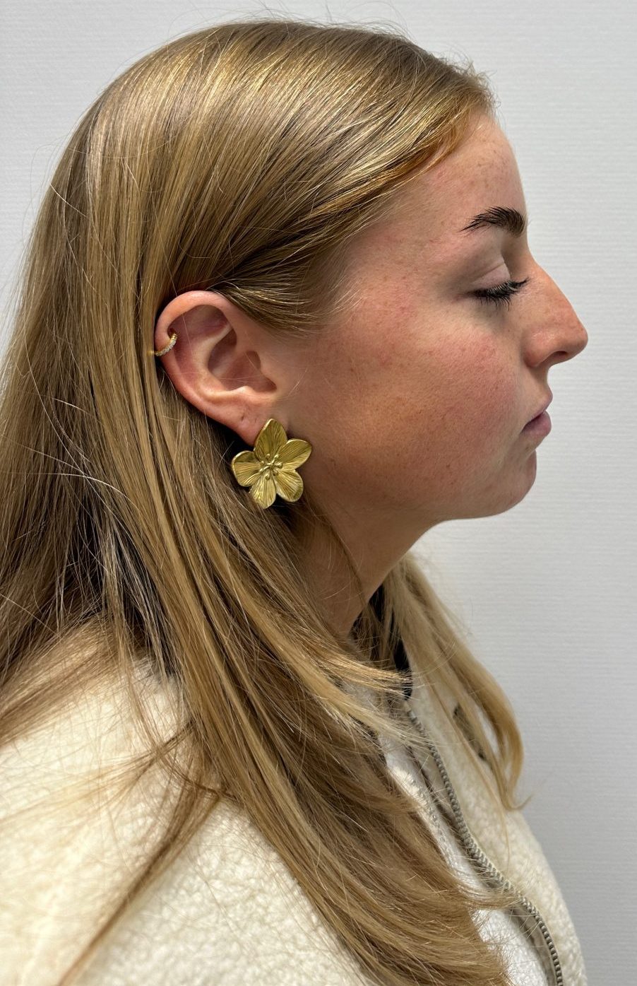 Nose correction before