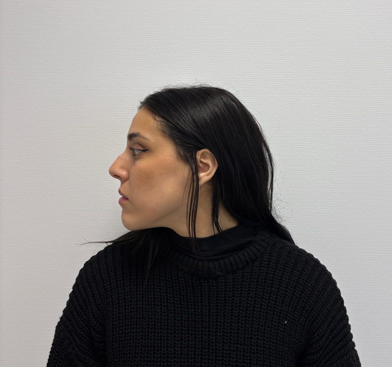 Nose correction before