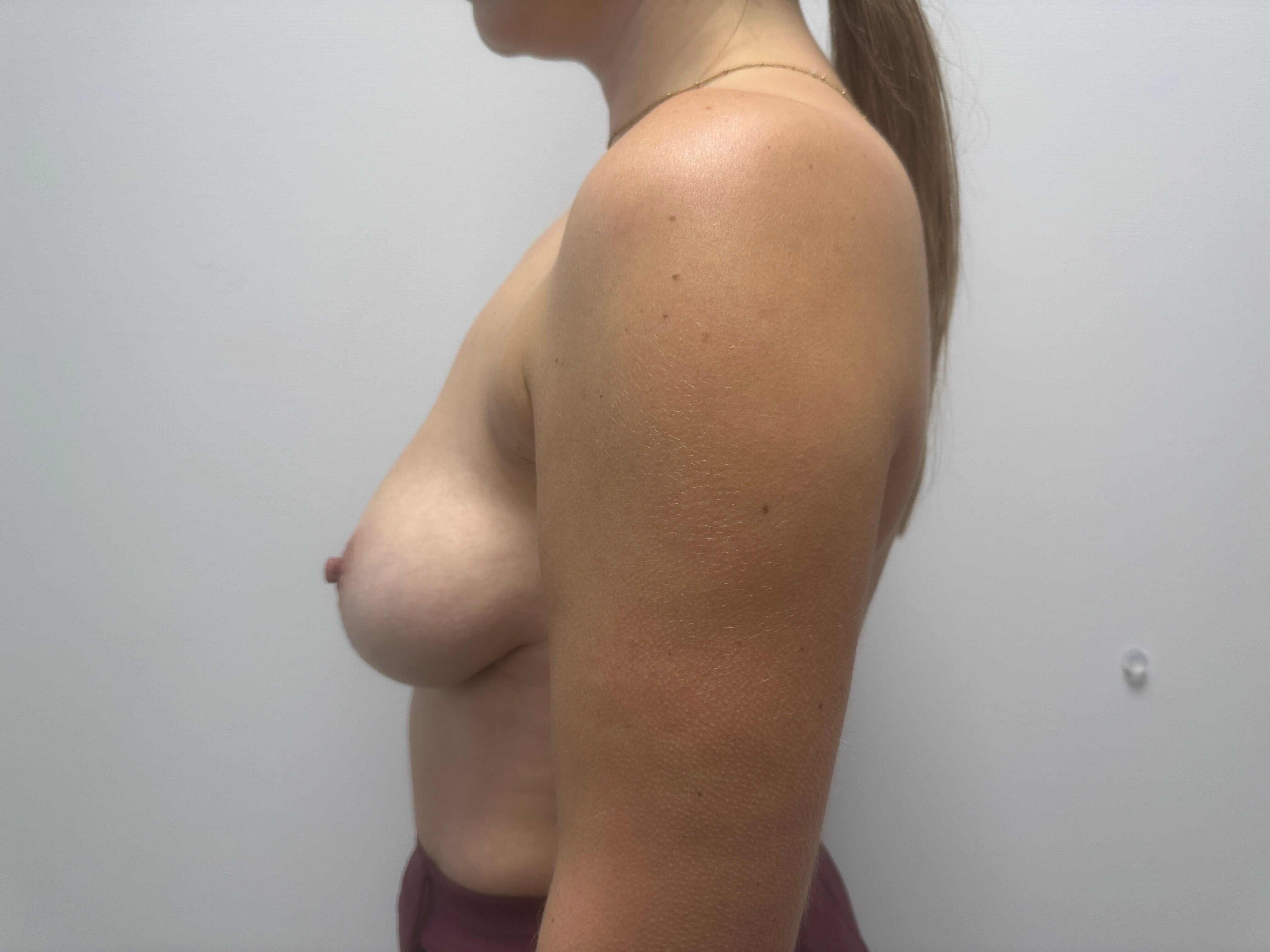 voor