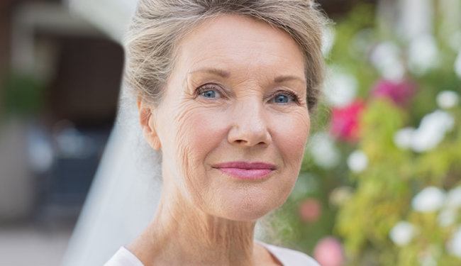 Facelift without surgery